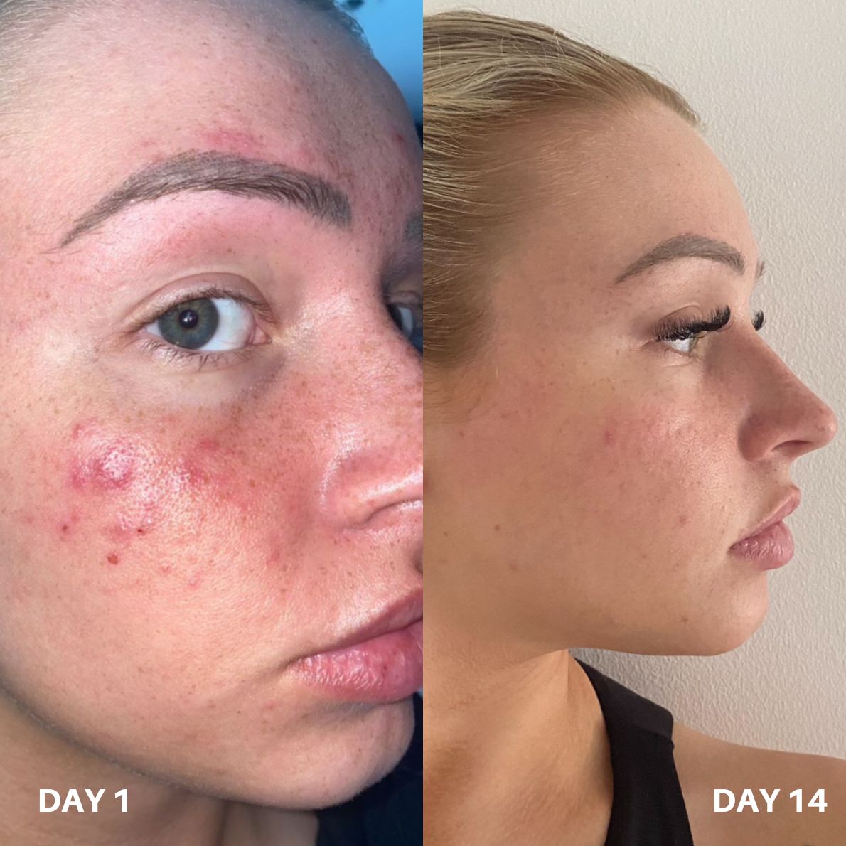 Clinisoothe+ Skin Purifier 250ML
